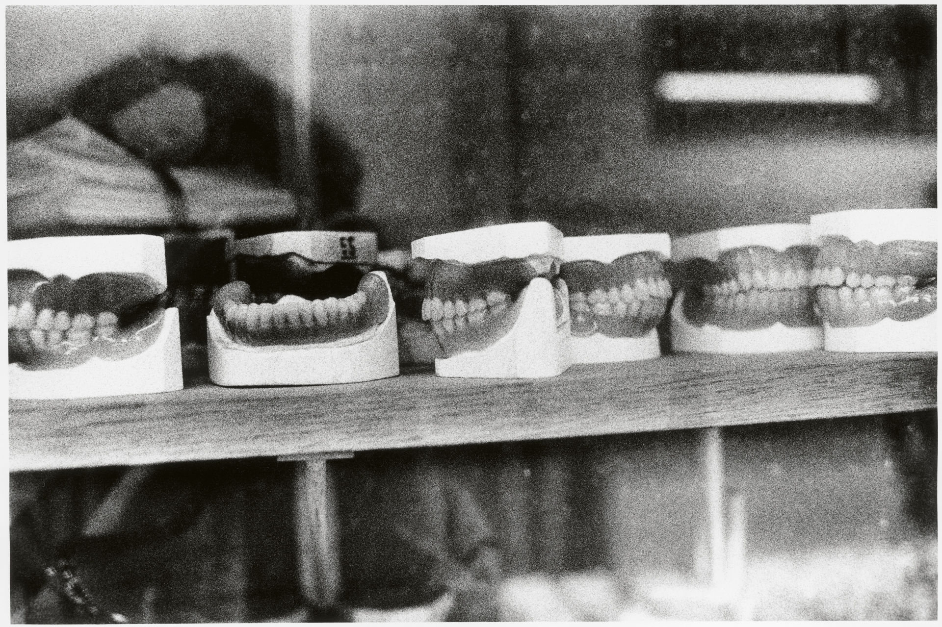 Blurred close-up detail of dental models or casts showing fine textural detail.