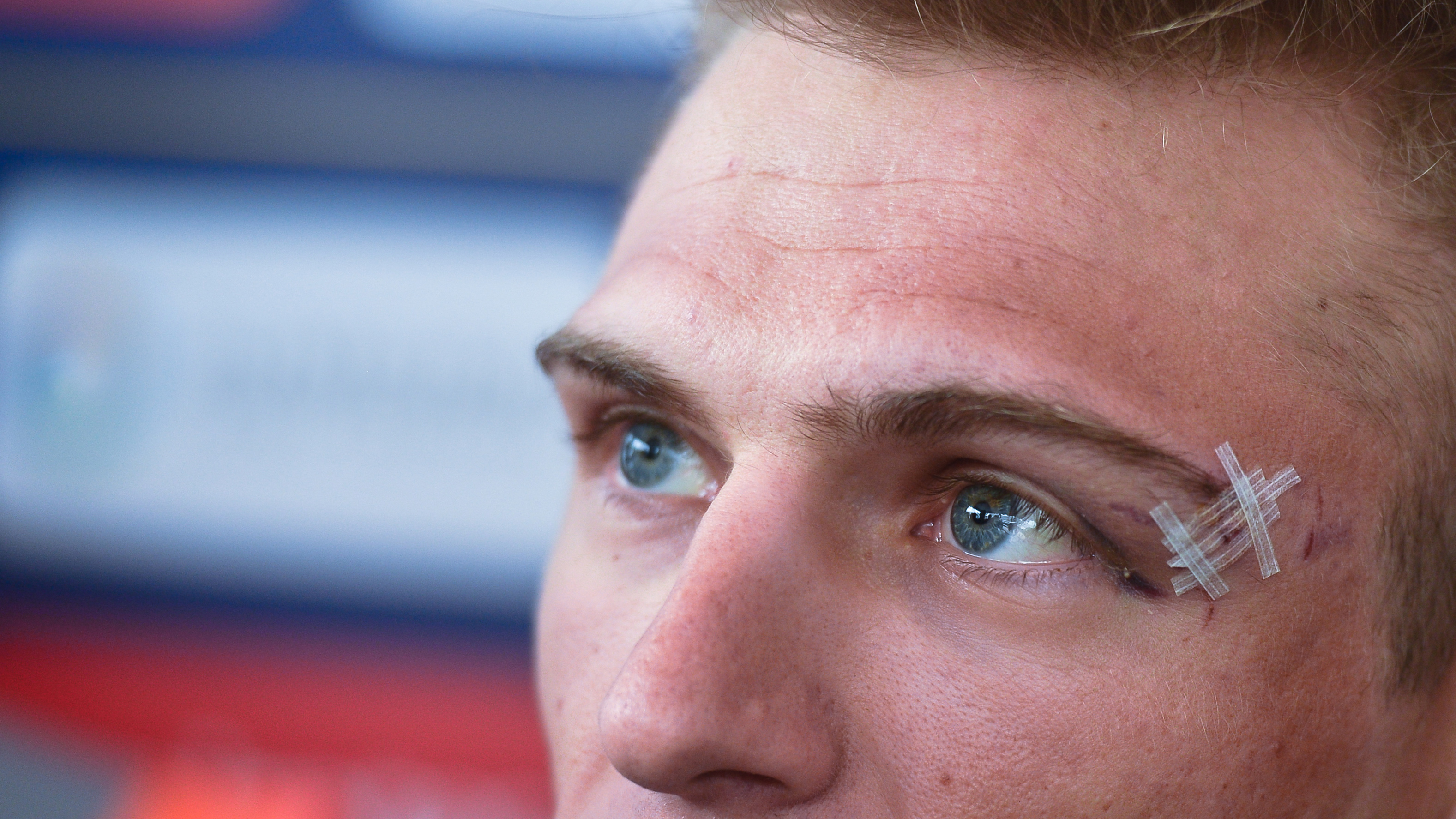 Marcel Kittel with his injured eye patched up during the 2017 Dubai Tour