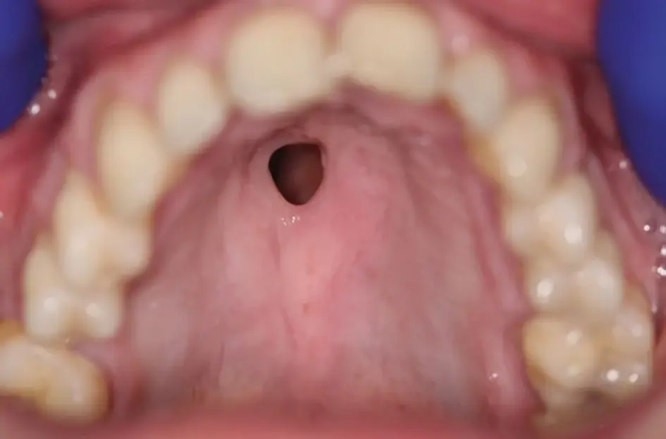 Not what you want (British Dental Journal)