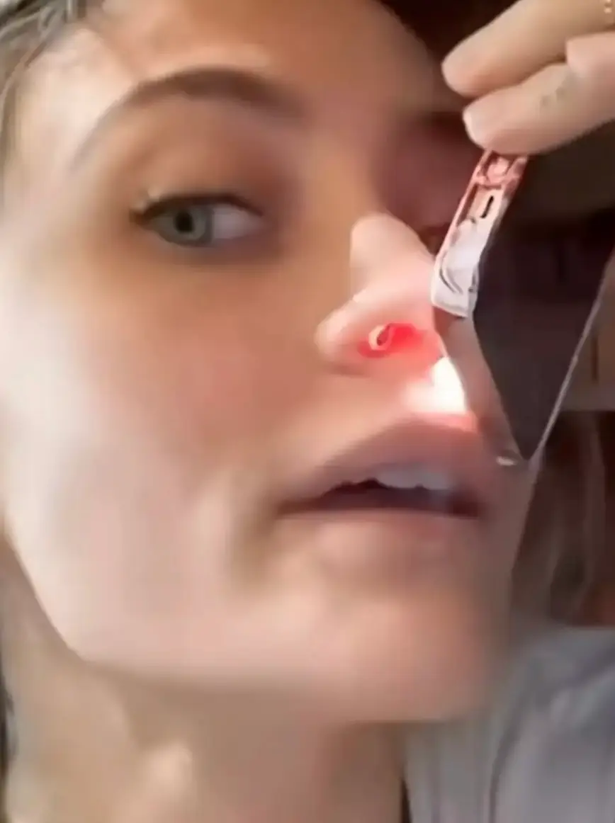 Paris Jackson previously showed the hole that has been left inside her nose due to drug abuse (TikTok/@parisjacksonbrasil)