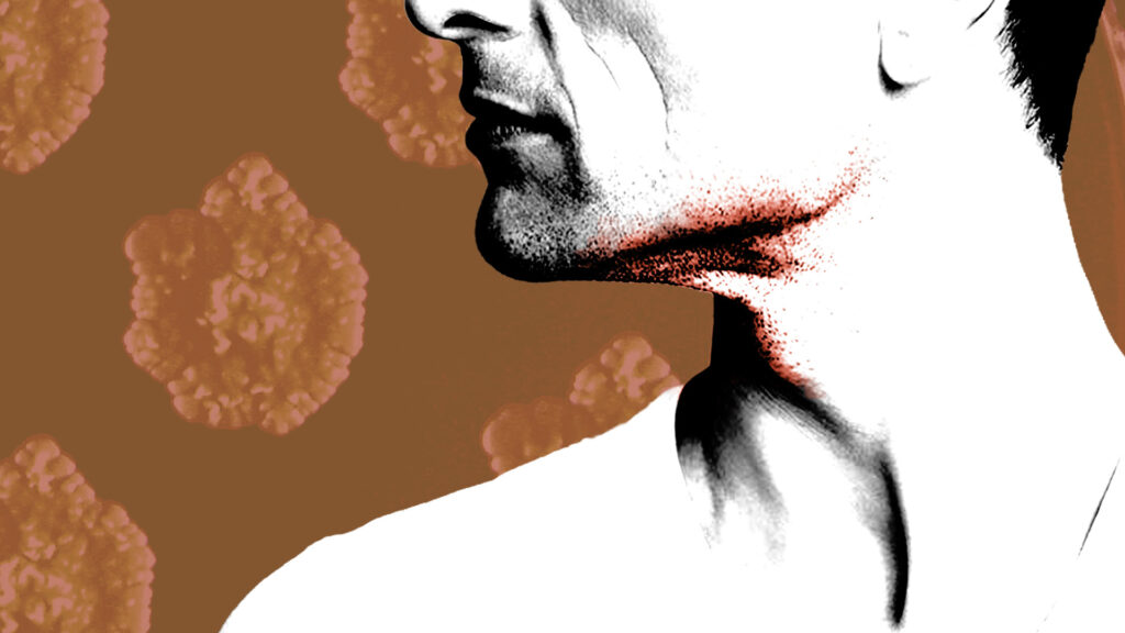 Doctors trace rare animal disease in sexual networks of gay men