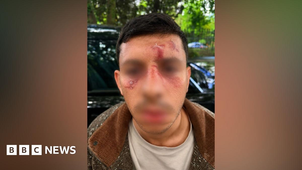 Man with short dark hair. Face visibly injured. Partly blurred