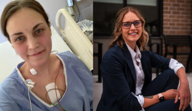 At 23, my shortness of breath and a swollen abdomen were diagnosed as gallbladder issues. They were actually signs of end-stage heart failure