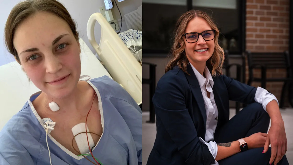 At 23, my shortness of breath and a swollen abdomen were diagnosed as gallbladder issues. They were actually signs of end-stage heart failure