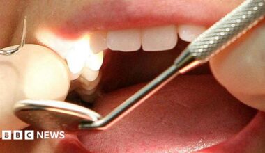 A patient's mouth being examined by a dentist who is wearing white gloves.