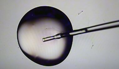 IVF treatment costs were supposed to drop under Trump. That’s still a long way off.