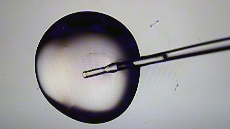 IVF treatment costs were supposed to drop under Trump. That’s still a long way off.