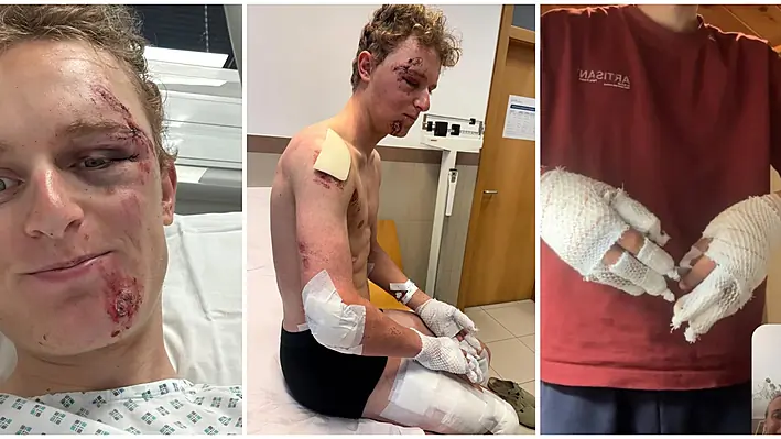 Lidl-Trek's Philipsen in 80kmph crash | "First time I’ve ever truly been scared"