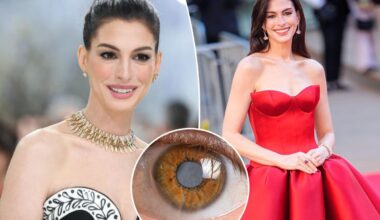Anne Hathaway's secret decade-long medical condition left her nearly blind throughout her 30s