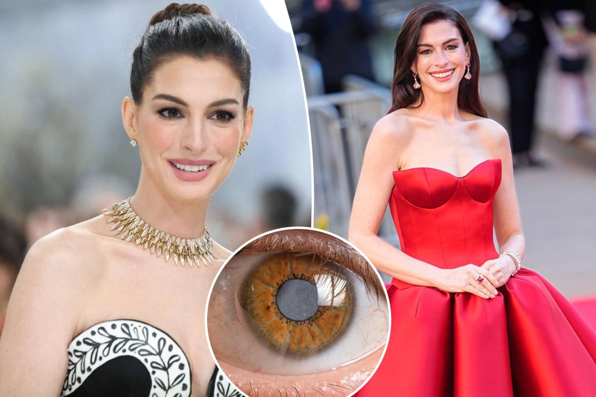 Anne Hathaway's secret decade-long medical condition left her nearly blind throughout her 30s