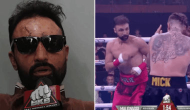 American bare-knuckle boxer blasts 'inept' NHS staff over his post-fight treatment