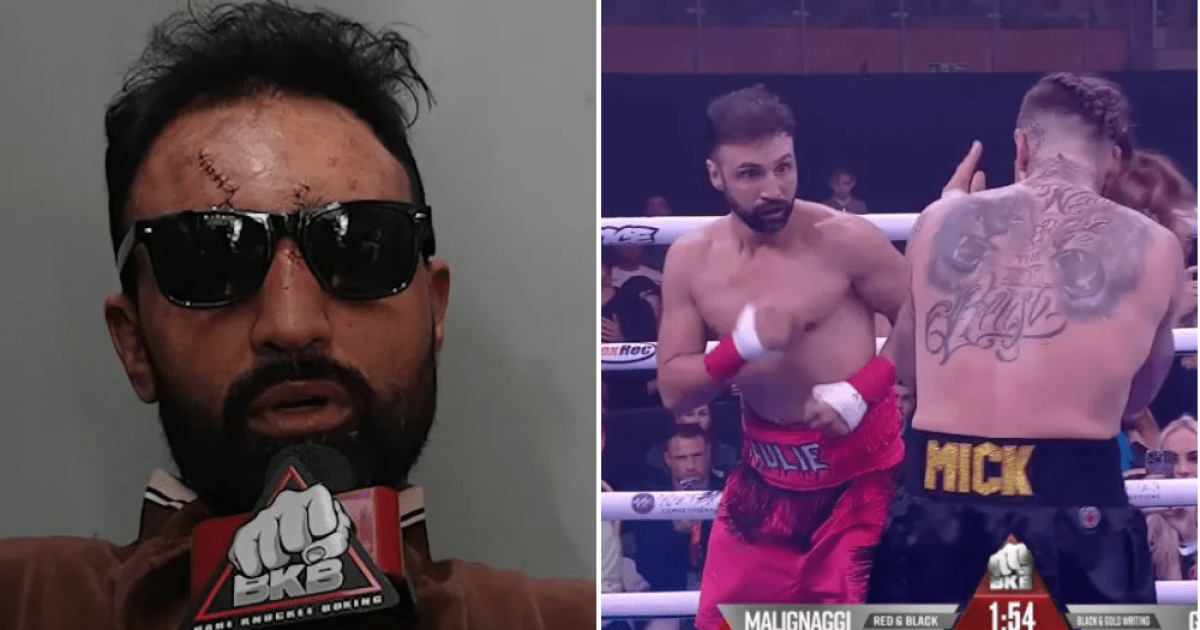 American bare-knuckle boxer blasts 'inept' NHS staff over his post-fight treatment