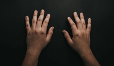 Does Handedness Affect Accidents at Work?
