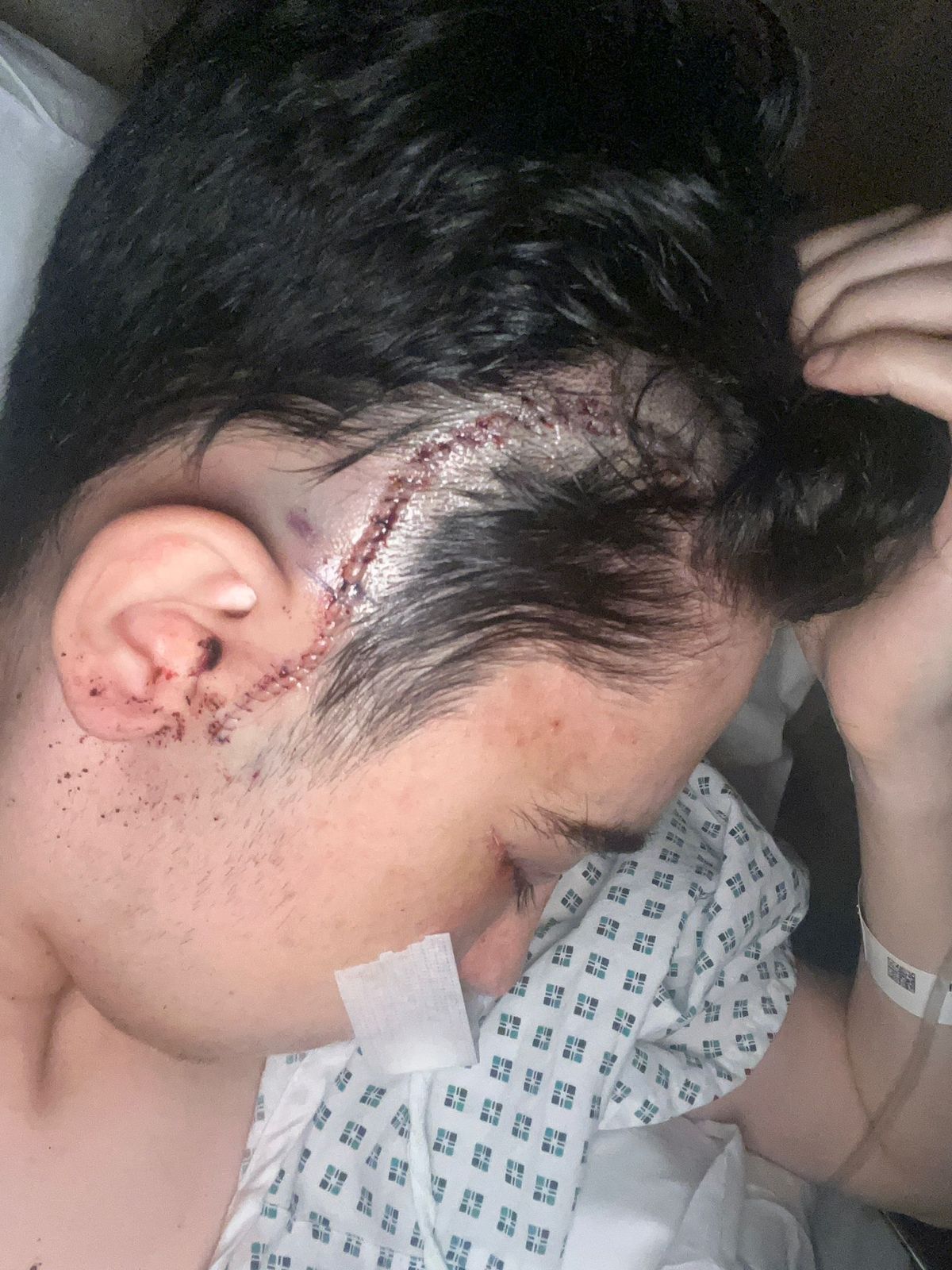 Sonny Barnett, 19, was punched in an unprovoked attack on Slater Street after work resulting in serious facial injuries