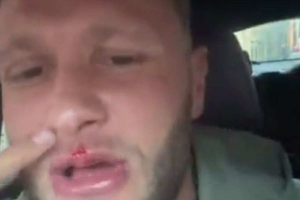 The “hardest man in the UK” Big Stacks was left bloodied