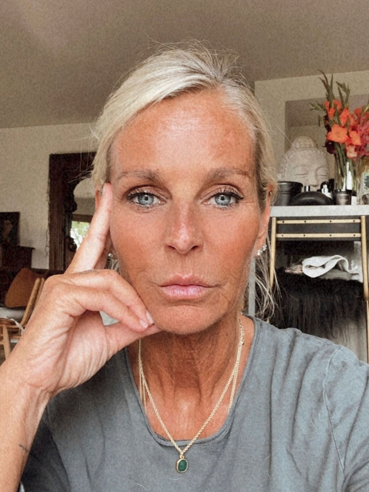 She has spoken about how sun damage caused her to age badly