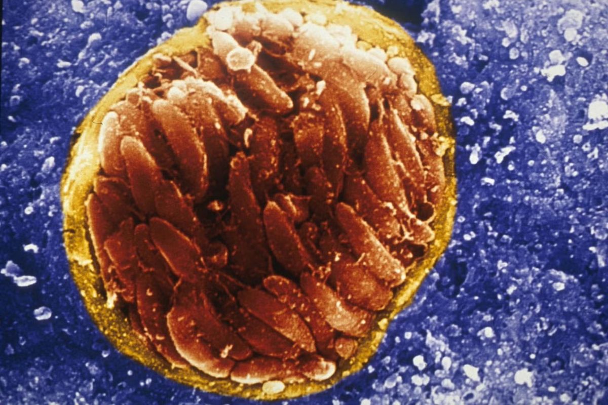 Toxoplasma gondii