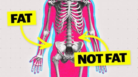 ‘I’ve lost my butt’: how rapid weight loss can leave you with less muscle and more fat