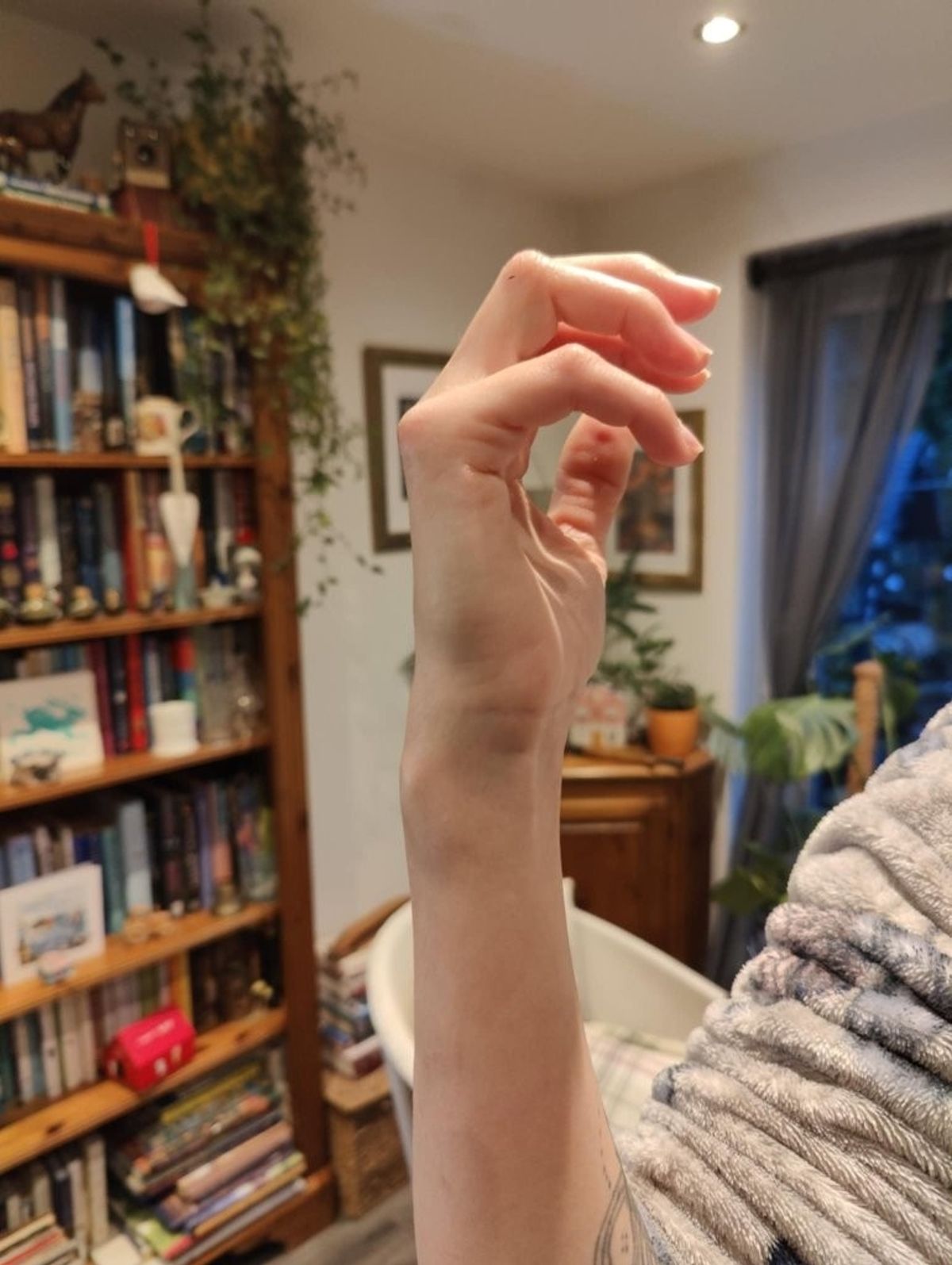 Sally's injured wrist