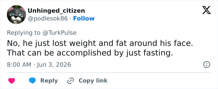 Comment suggesting weight loss and fasting cause facial changes Comment suggesting weight loss and fasting cause facial changes