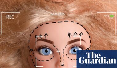 ‘The face doesn’t move’: Hollywood’s obsession with cosmetic surgeries has led to stiffer looks – and performances | Cosmetic surgery