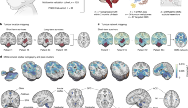 A prognostic human brain network for diffuse midline glioma