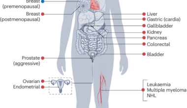 Adiposity and cancer: epidemiology, mechanisms and future perspectives