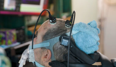 AI and brain-computer interface allow speechless ALS patient to work a full-time job