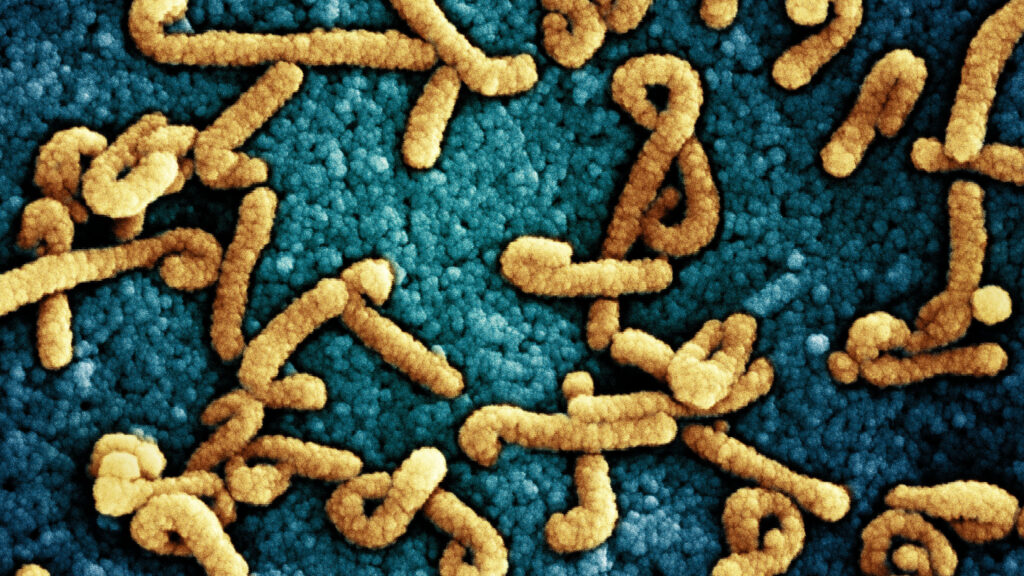 Marburg virus cases reported in Ugandan ebola outbreak area