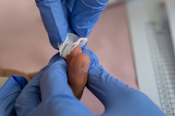 a doctor or medical personnel wearing blue gloves is wiping the blood on a patient's fingertip with gauze after taking a sample a doctor or medical personnel wearing blue gloves is wiping the blood on a patient's fingertip with gauze after taking a sample