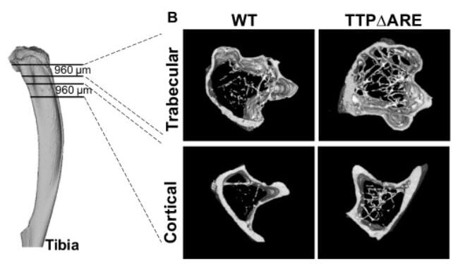 An Anti-Aging Protein May Eventually Help Reverse Some of The Effects of Aging