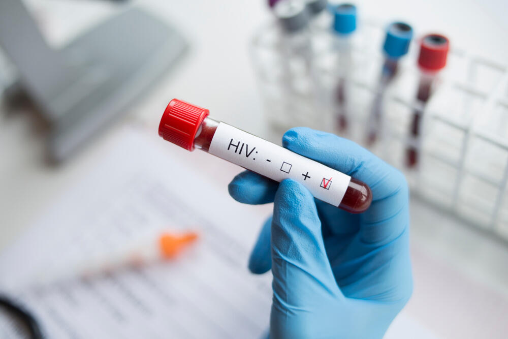 At least 10% do not know they are carriers (Photo: Shutterstock) איידס HIV בדיקת דם