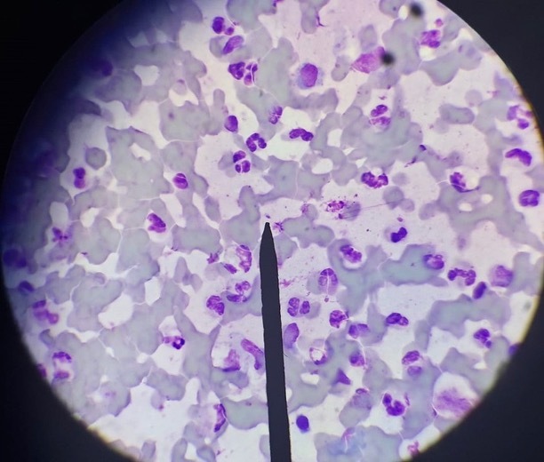 microscopy showing numerous Leishmania parasites