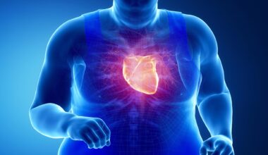 Obese Man Exercise Heart Attack Illustration