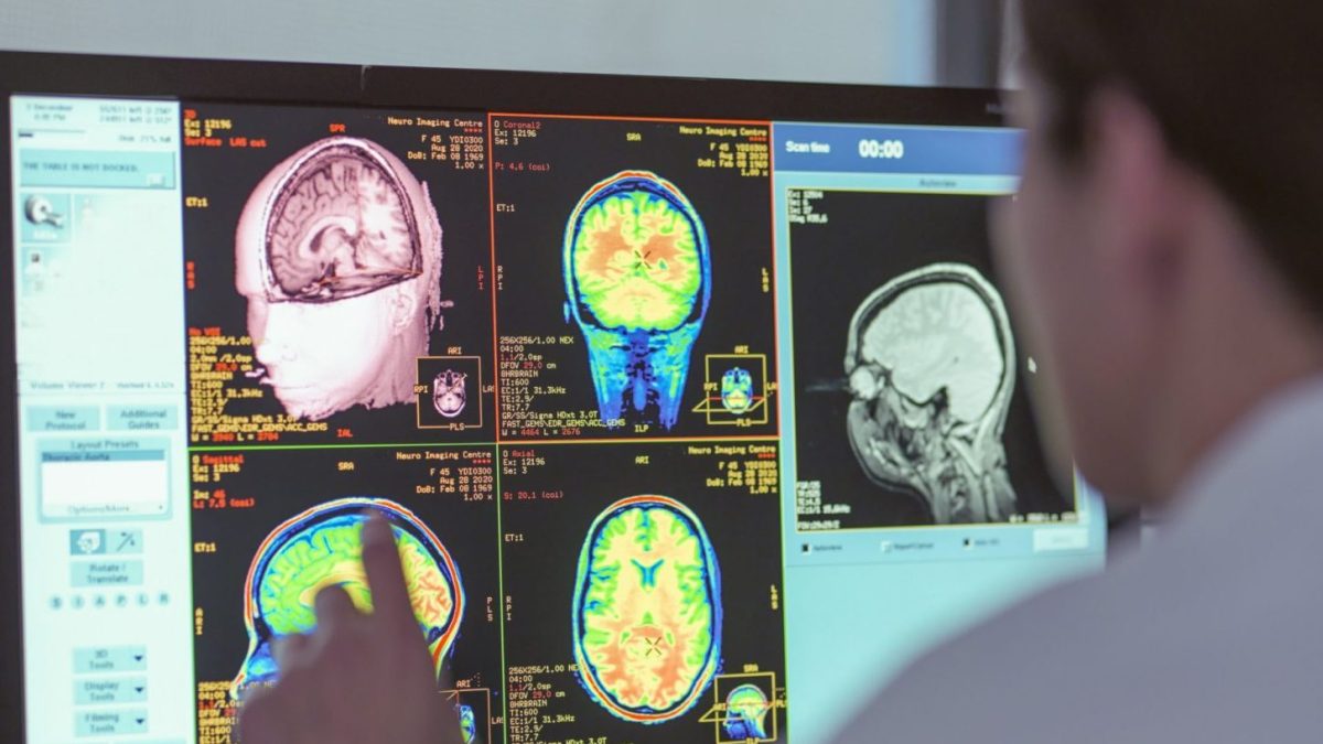 The little-known mineral that could help treat Alzheimer's