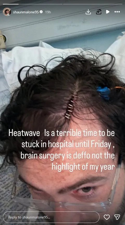 Shaun Malone shares a picture of his surgery stitches on Instagram