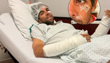 Michael Matthews fire engine injuries 2026
