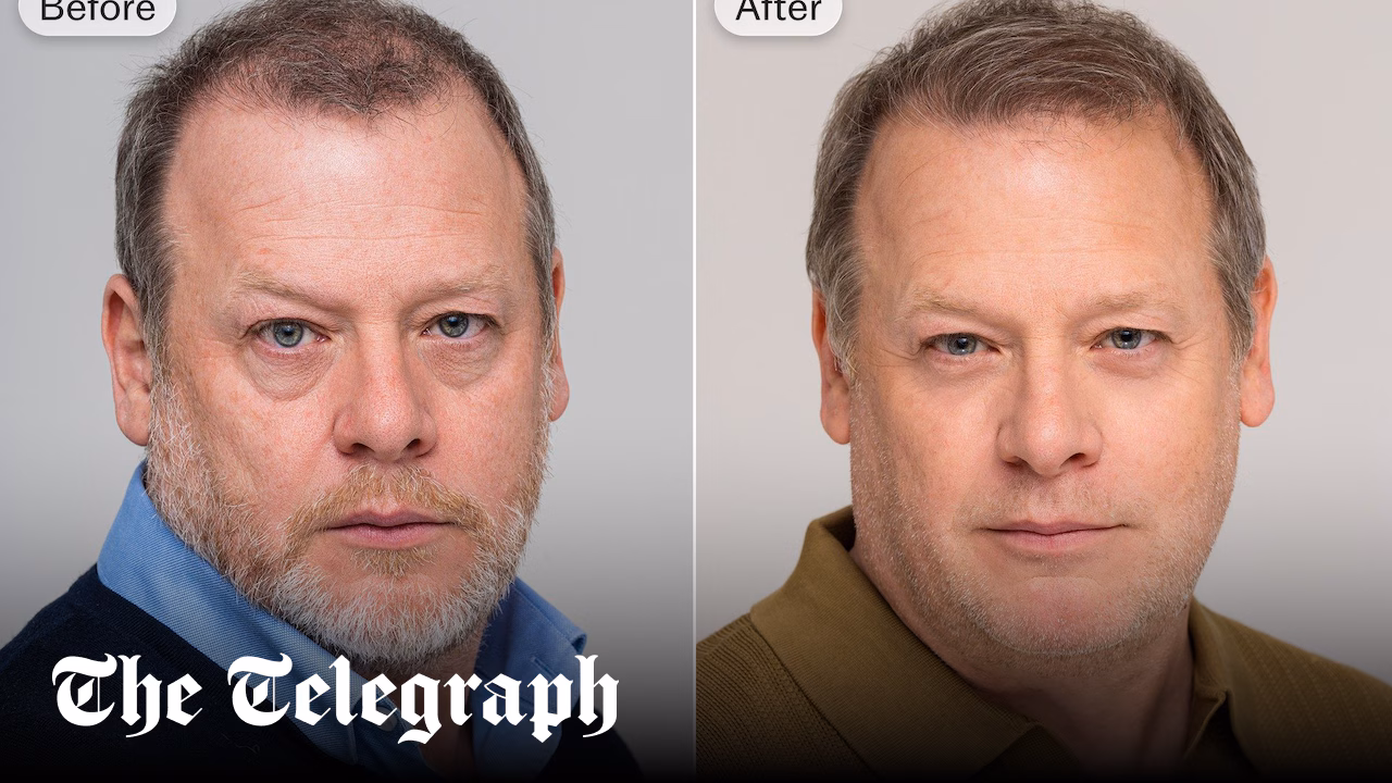 I swapped washing my face with shampoo for a soap