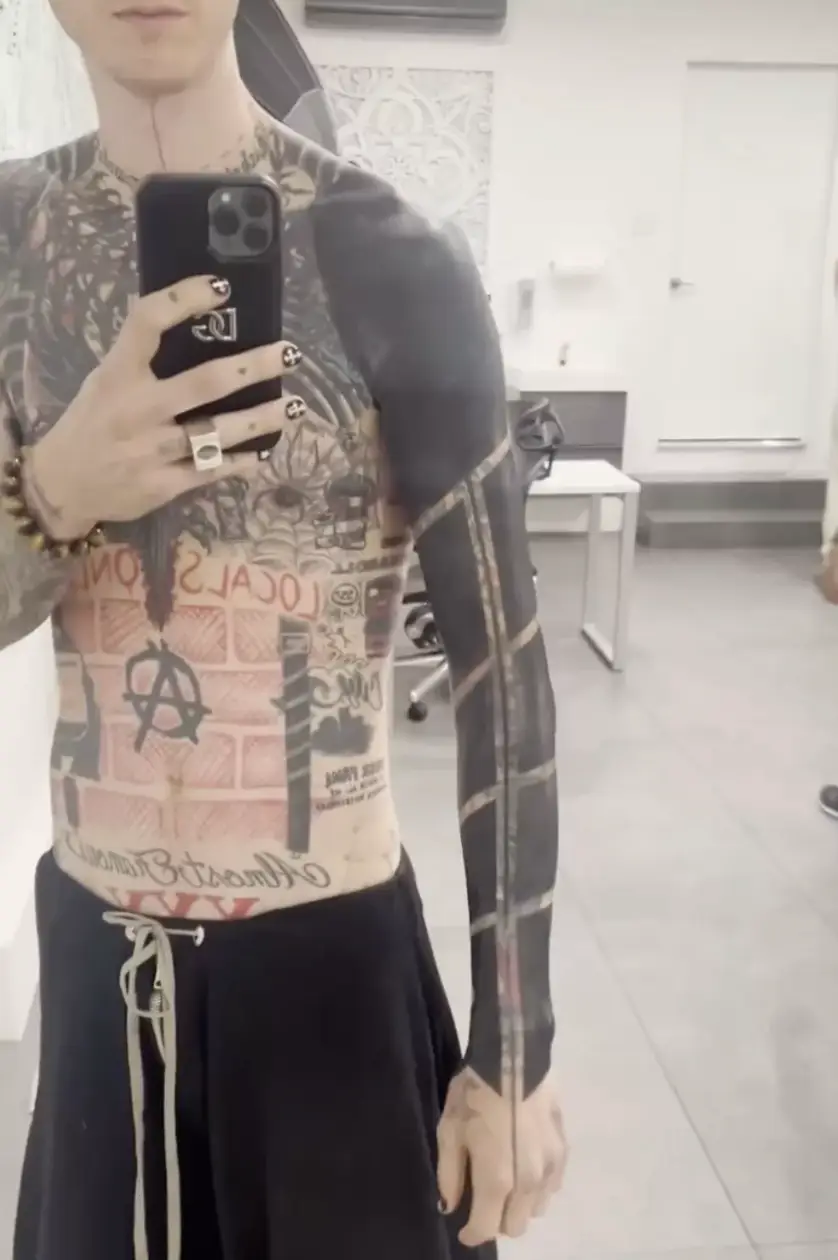 The rapper shared the grueling process with fans (Instagram/@machinegunkelly)