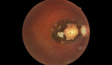 Cat parasite infecting third of humans is 'major cause of vision loss', scientists warn