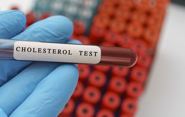 Cholesterol blood test, conceptual image Cholesterol blood test, conceptual image
