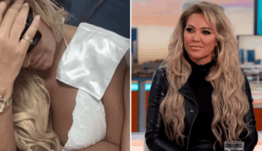 Reality star 'scarred for life' after being mauled by XL Bully