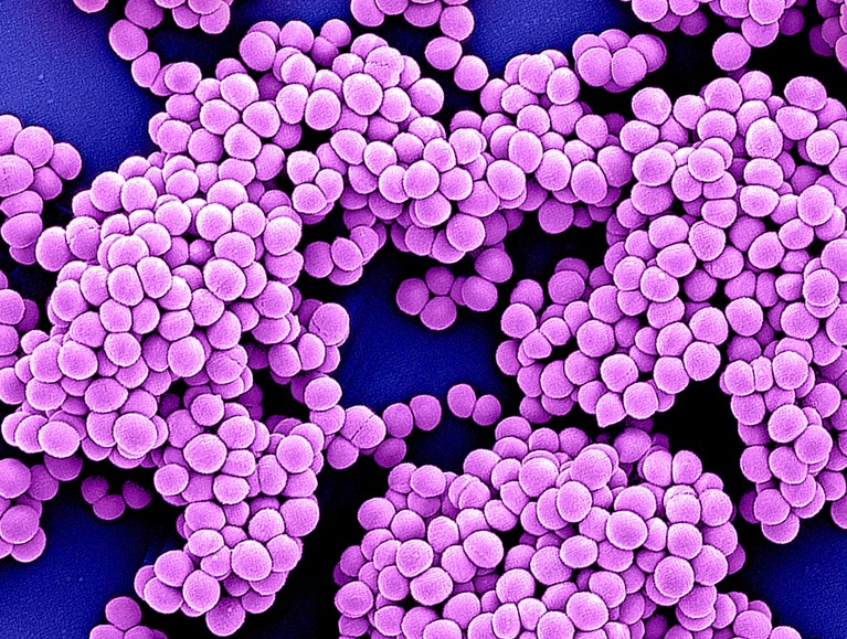 Coloured scanning electron micrograph (SEM) of methicillin-resistant Staphylococcus aureus (MRSA) coccoid (spherical) bacteria (pink).