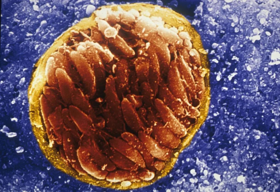 Scanning electron micrograph of the Toxoplasmosis parasite cyst (David Ferguson via Eurekalert)