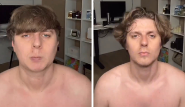Man Reveals Dramatic 80-Day Transformation After Daily Jaw Exercises