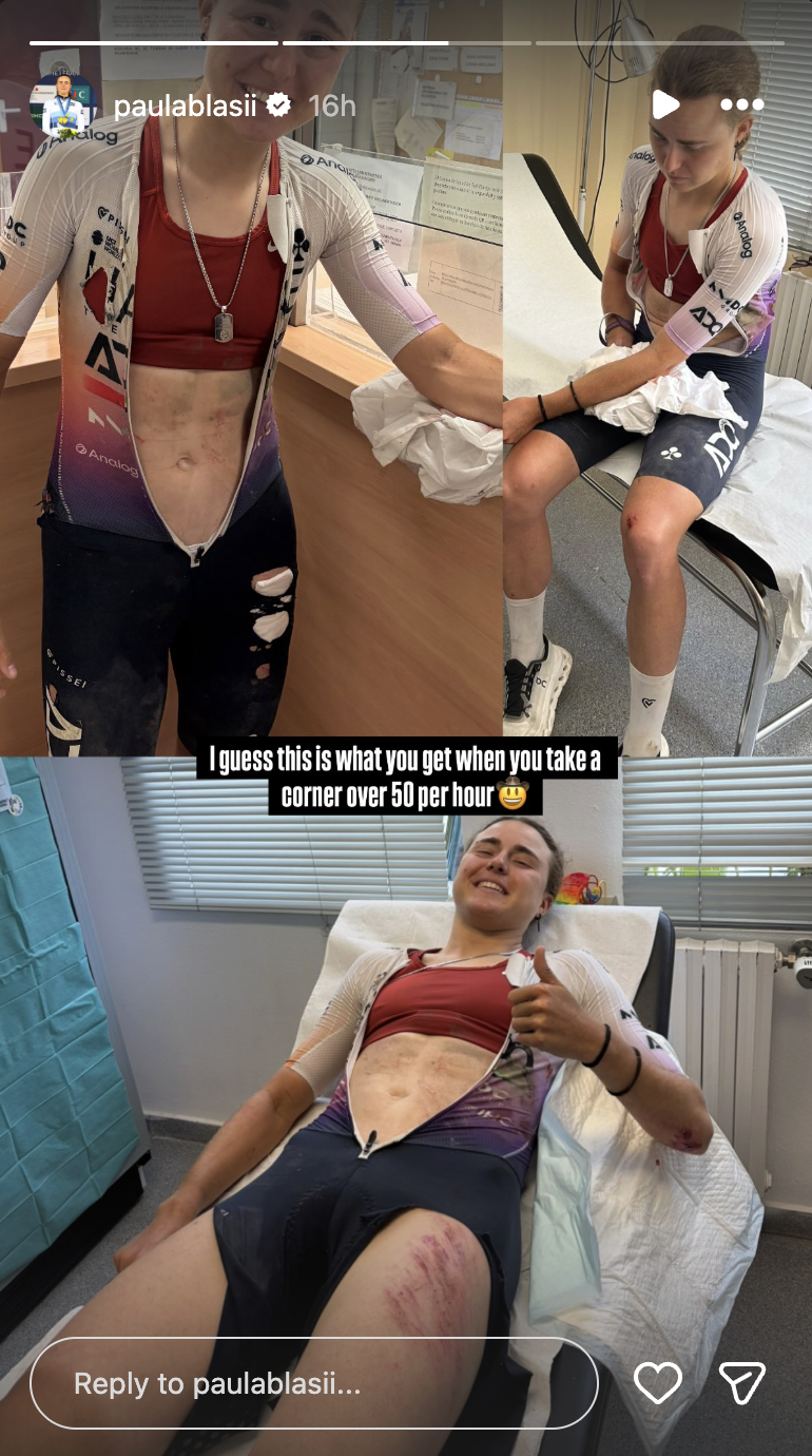 Collage of photos of Paula Blasi with abrasions after a crash, but she is smiling