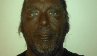 Dermatologist explains what happens to your body after you take Melanotan II