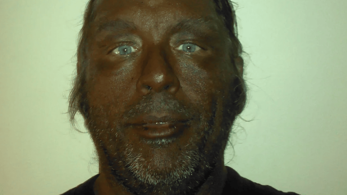 Dermatologist explains what happens to your body after you take Melanotan II