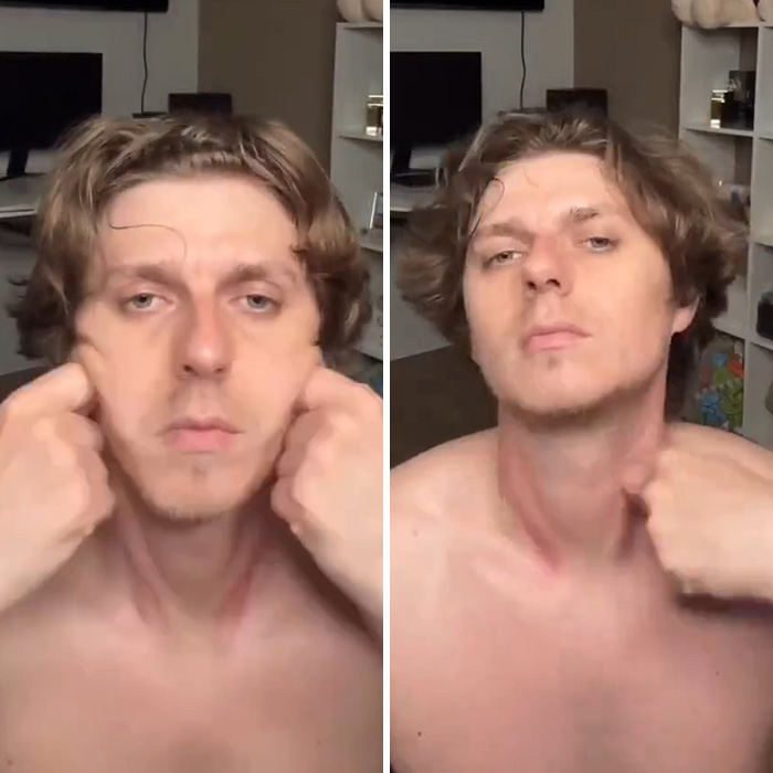 Man showing jaw exercise effect on jawline in 80-day transformation Man showing jaw exercise effect on jawline in 80-day transformation