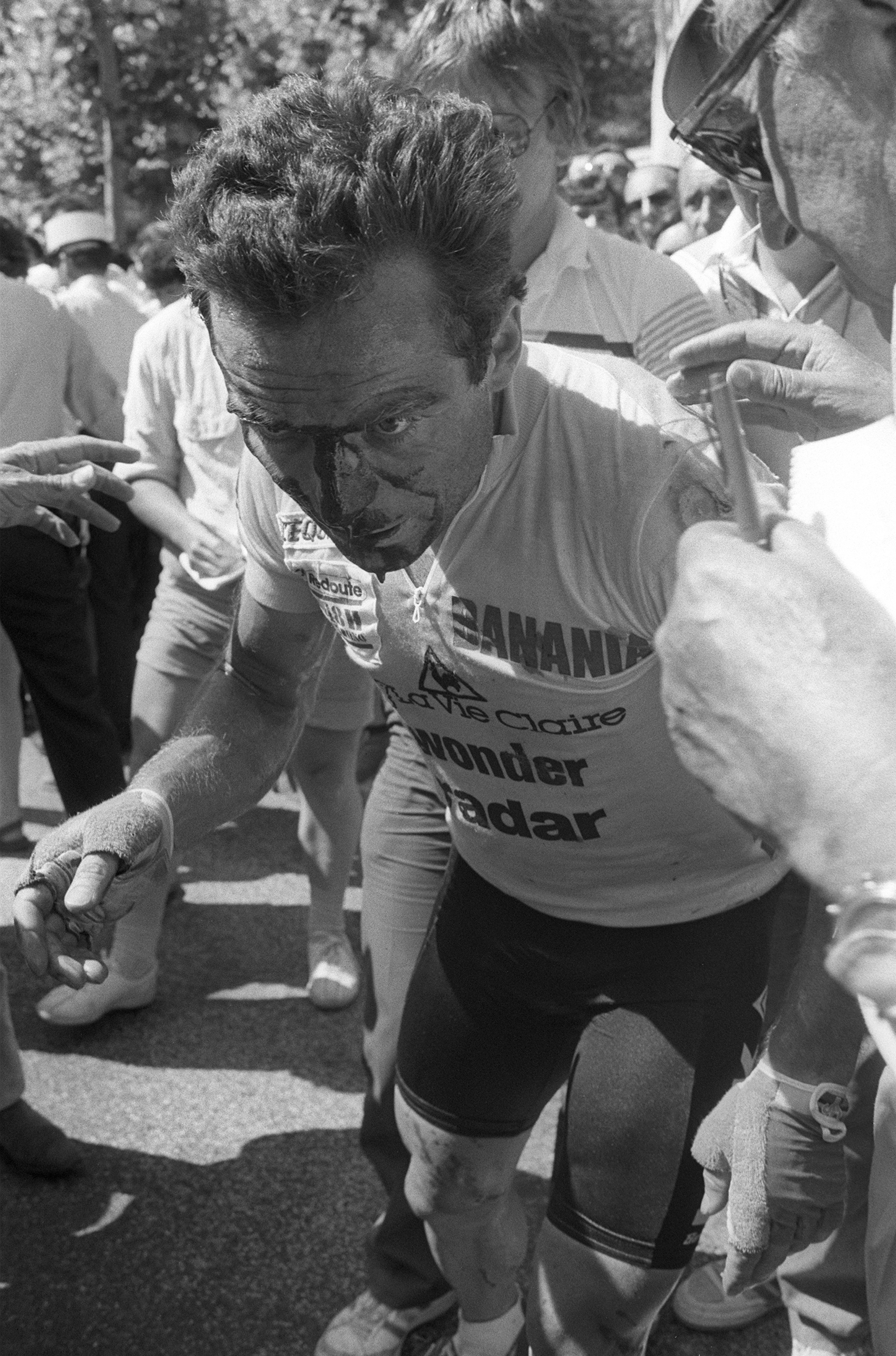 Bernard Hinault with a bloodied face